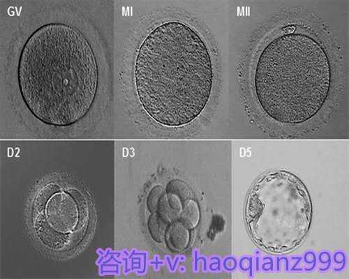 广州供卵医院公立，广州供卵供精一起做的试管可以去哪家机构做？哪家可靠？