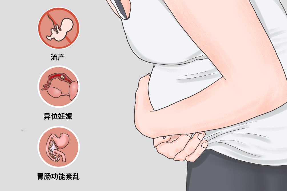 广州代孕价格低-广州代孕是否要求血型？
