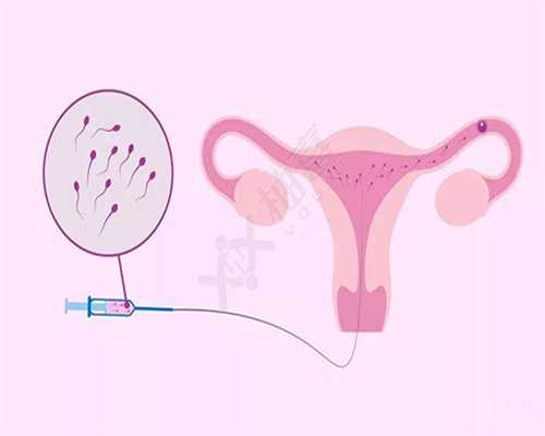 代孕初期用消糜栓对胎儿有影响吗